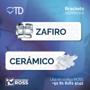 Brackets Estéticos